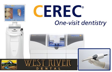 Cerec Dental Imaging by West River Dental in Bend Oregon